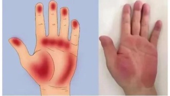 毀身傷肝四大惡習(xí)，傷身更變丑！春季“養(yǎng)肝”＝“養(yǎng)命”