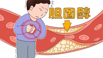 胆固醇含量最高的食物竟然是它，不是鸡蛋和猪肝、肥肠，你肯定想不到