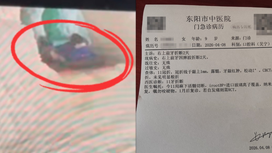 9岁女童坐冰雪滑梯被后面游客撞倒磕断牙齿，景区：正在协商赔偿