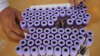 第000期：開(kāi)欄的話｜《夢(mèng)澤一分鐘·科普干細(xì)胞》開(kāi)欄了