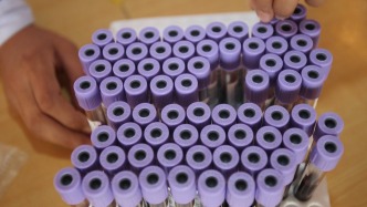 第001期：何為干細(xì)胞？｜夢(mèng)澤一分鐘·科普干細(xì)胞