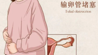 輸卵管黏連會(huì)影響懷孕嗎？