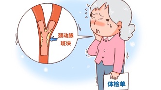 降胆固醇 这样用药效果更好且不增加副作用