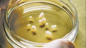 腦類器官研究步入快車道