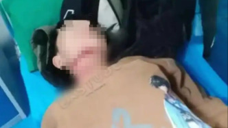 沁阳骑车被绳“锁喉”男孩已脱离生命危险，涉案者被采取刑事强制措施
