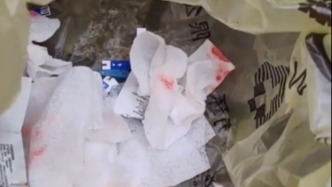 杭州共用采血針15人將被定期監(jiān)測(cè)，涉事診所員工已被開除