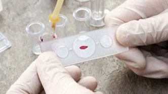 血型能決定壽命？A型、B型、O型、AB型，哪種血型更容易患癌？