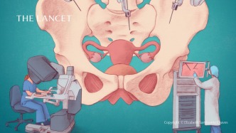 確診往往晚期，半數(shù)患者可能活不過(guò)5年，體檢難查出，但依舊建議你這么做