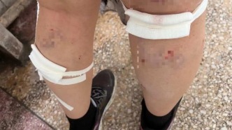 平頂山學院通報學生被流浪狗咬傷：傷情平穩(wěn)，已對流浪動物進行專業(yè)處置