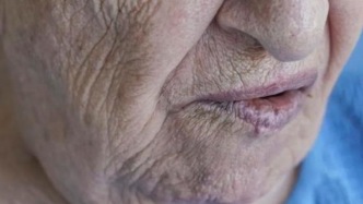 壽命長(zhǎng)短，面相先知？無論男女，臉上10種表現(xiàn)，或是疾病