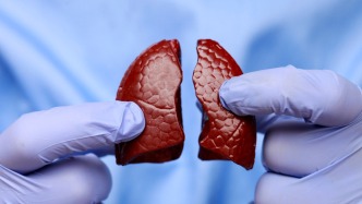 體檢發(fā)現(xiàn)肺結(jié)節(jié)，先別著急“一刀切”｜健康有方FM