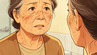 美时美课 | 察言观色：40岁长“老年斑”？可能不是“老“的问题