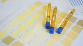 服药后尿液变色？这些情况要警惕 | 科学用药护健康