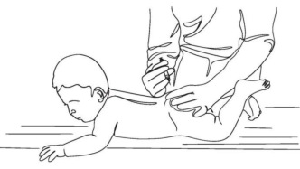 宝宝接种疫苗后，家长要知道这些事