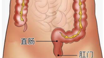 這4個(gè)癥狀一出現(xiàn)，千萬(wàn)別當(dāng)成痔瘡！很多人拖到晚期才發(fā)現(xiàn)