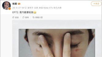 杨幂晒照，脸部遭烫伤，不少网友慌了：我也这么干过