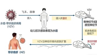 以为只是过敏？春天这种疼痛“元凶”高发，早治少受罪