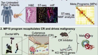Cancer Cell：清華大學通過空間轉錄組學揭示胰腺癌惡性轉化的基礎在于一種保守的再上皮化程序