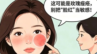 玫瑰痤瘡：別把“臉紅”當(dāng)敏感