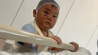母子二人遭遇車禍，3歲寶寶雖鼻青臉腫卻一直守在媽媽身旁