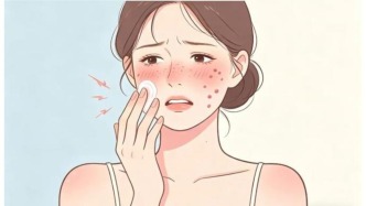 臉紅、長(zhǎng)痘總反復(fù)？別再把“玫瑰痤瘡”當(dāng)敏感肌亂治了