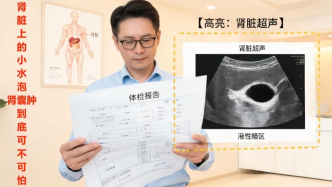 腎臟上的“小水泡”——腎囊腫到底可不可怕？
