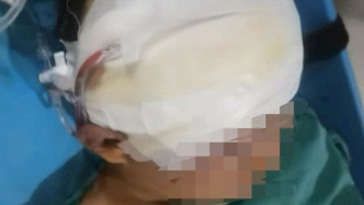 湖北阳新通报13岁男生在青少年基地被打伤：涉事员工被刑拘