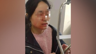 女教师称因制止学生打架被六年级女生戳伤眼球，校方：已进行工伤认定，将组织双方调解