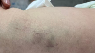 陕西一新生儿遭月子中心护工用力拍打，家属起诉月子中心索赔