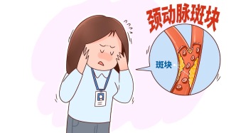 中老年人必须要查颈动脉斑块，并且每3年都要查一次！真的很重要！