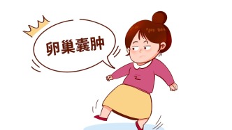科普 | 体检查出卵巢囊肿，别慌！多数不用开刀