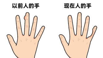 第一批用小拇指当手机支架的人，已经在康复科了