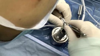 感冒迁延诱发暴发性重症心肌炎，26岁女子装上“人工心脏”绝境重生