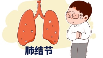 作为一个呼吸科主任医师，我要向大家如实交代，我自己也有肺部结节