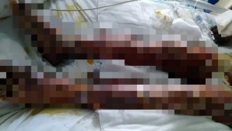 云南楚雄一工地住房起火致3死2伤，当地政府部门正调查处理