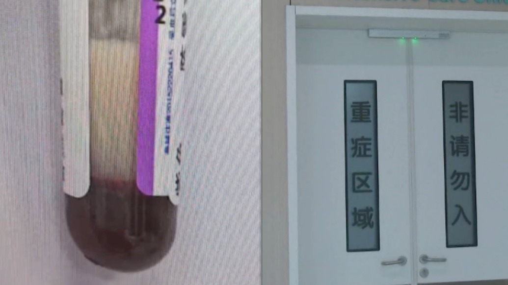 39岁女子血液变牛奶色住进ICU三次血浆置换，医生：患者自述近半个月每天喝三四杯奶茶