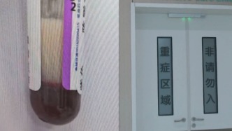 39岁女子血液变牛奶色住进ICU三次血浆置换，医生：患者自述近半个月每天喝三四杯奶茶