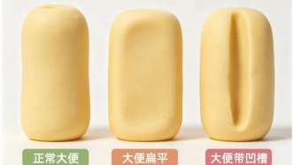 肠道里有息肉，大便时会有4个提示，别等肠癌了才知道