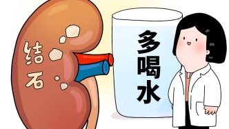 科普 | 有些结石不能“多喝水”！那些被误解的排石小妙招