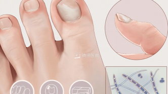 指甲上长出不疼不痒的黑线，竟可能暗藏致命危险？