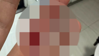 女子回应“家庭纠纷拉扯过程咬伤孕期弟妹”：她持续辱骂家婆等家人