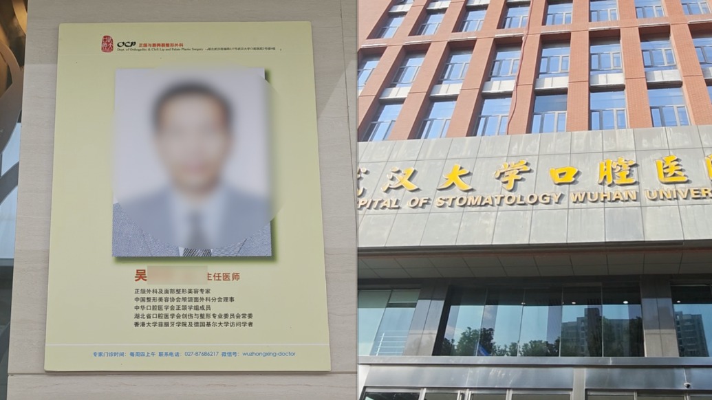 卫健局调查“女孩称正颌手术被做反”，记者实探武大口腔医院：涉事医生照片仍在专家栏，护士称人不在