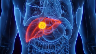 肝癌是如何肺转移的？中国科学家首次完整还原全过程