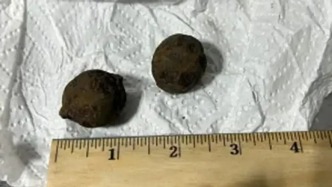 安检员扫到5个完全看不透的神秘圆球，打开后立刻叫来了爆炸物专家