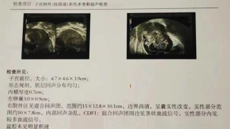 我勉强吃下一颗草莓，然后红红的草莓汁混合着胆汁一起往外翻涌