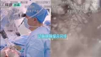 “i人”医生高石：不爱出镜，却为“断指”第一次对外“营业”