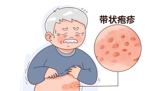 巨疼！会传染！过度劳累、熬夜很可能会引起这种病，务必注意