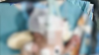 新生男婴脑损伤的原因未定，宽甸县卫健局：家长撤回鉴定申请，建议走司法渠道解决 