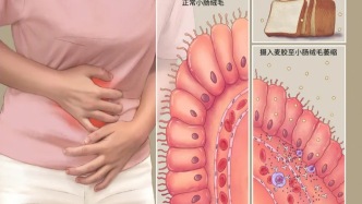 大便粘马桶，冲都冲不掉，是肠癌吗？医生：先别慌