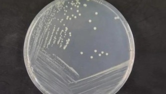 死亡率超40%、煮沸也杀不死！这种致命菌，藏在3种类食物里